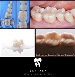 Dentalp SA
